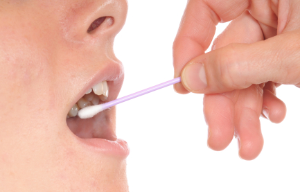 Cheek swab being done for a DNA test to determine paternity